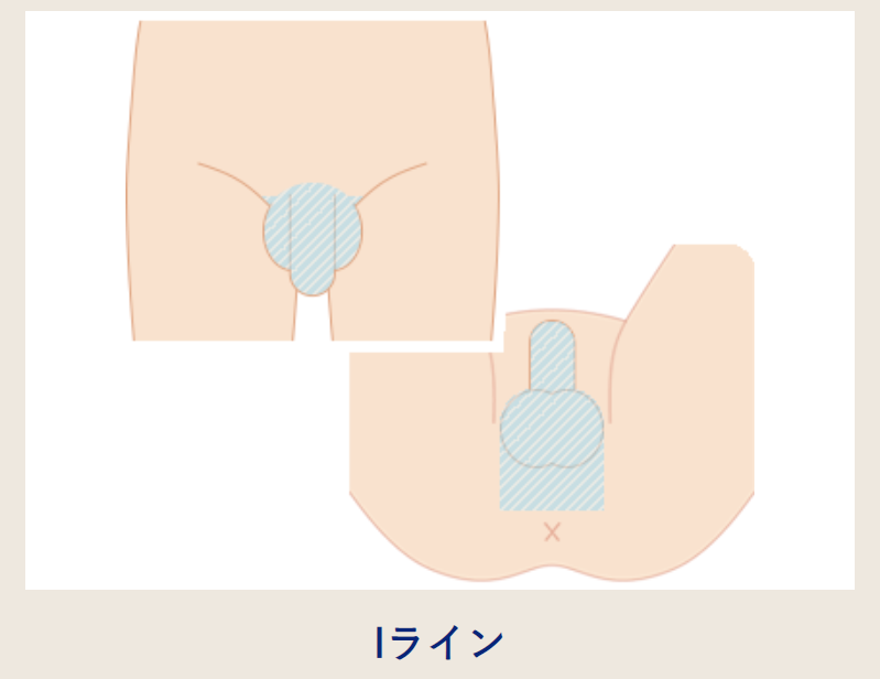Iラインの範囲