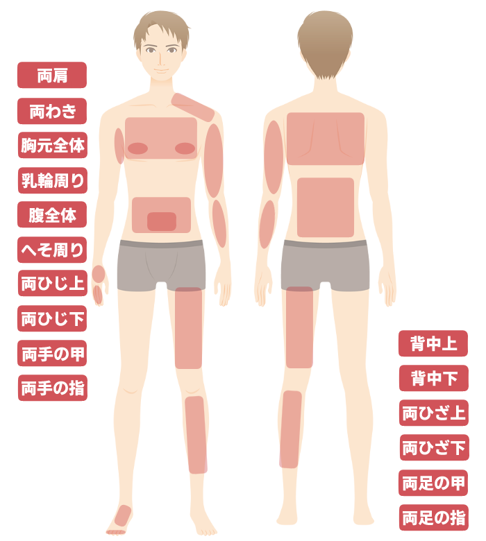 メンズクリア脱毛可能部位