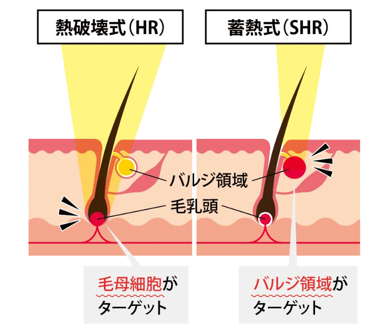 熱破壊式と蓄熱式の違い