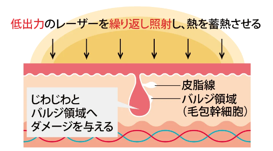 ヴィーナスワンの特徴