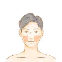 RINX（リンクス）両ほほ
